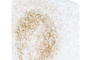 Immunohistochemistry (IHC) image for anti-Fc Fragment of IgE, Low Affinity II, Receptor For (CD23) (FCER2) (AA 48-321) antibody (ABIN7795823)