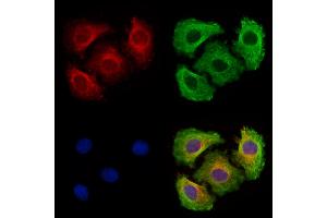 ABIN7094858 and ABIN7098909 staining Hela cells by IF/ICC.