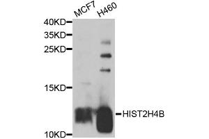 Western blot analysis of extracts of various cell lines, using HIST2H4B antibody (ABIN5974305) at 1/1000 dilution. (Histone Cluster 2, H4b (HIST2H4B) Antikörper)