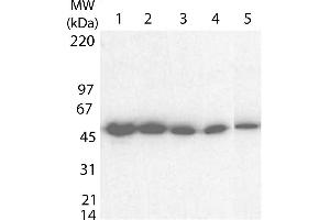 Western blot using  Anti-Tetanus Toxin C antibody shows detection of a band at ~52 kDa corresponding to full length 6X His-TTFC fusion protein (arrowhead). (Tetanus Toxin C-Fragment (TTC) Antikörper)