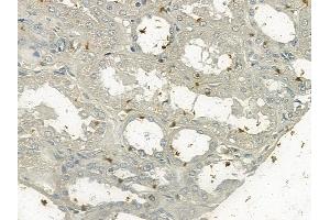 ABIN6255032 and ABIN6267089 at 1/100 staining human normal kidney tissue by IHC-P.