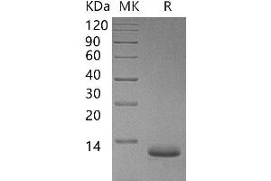 Western Blotting (WB) image for S100 Calcium Binding Protein A11 (S100A11) (Active) protein (His tag) (ABIN7320783) (S100A11 Protein (His tag))