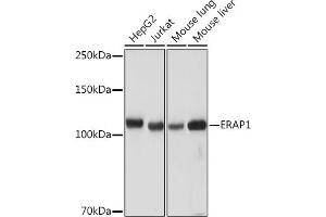 Western blot analysis of extracts of various cell lines, using ER Rabbit mAb (ABIN7266941) at 1:1000 dilution. (ERAP1 Antikörper)