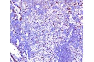 IHC analysis of CXCL12 using anti-CXCL12 antibody (ABIN6719467).