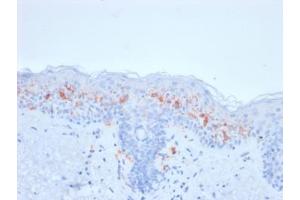 IHC testing of FFPE human skin with recombinant CD1a antibody (clone rC1A/711). (CD1a Antikörper)