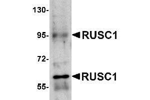 Western blot analysis of RUSC1 in A-20 cell lysate with RUSC1 antibody at 1 µg/mL. (RUSC1 Antikörper  (C-Term))
