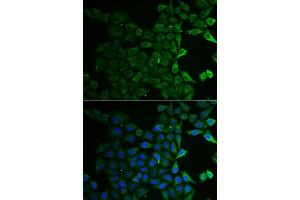 Immunofluorescence analysis of U2OS cells using C21orf33 antibody. (C21orf33 Antikörper  (AA 42-268))