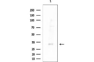 Western blot analysis of lysates from EC304 cells(heat-shock treatment), using GPR105 Antibody at 1/1000 dilution.
