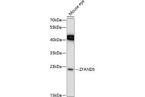 Western blot analysis of extracts of mouse eye, using ZF Antibody (ABIN6130935, ABIN6150428, ABIN6150429 and ABIN6217088) at 1:1000 dilution. (ZFAND5 Antikörper  (AA 40-150))