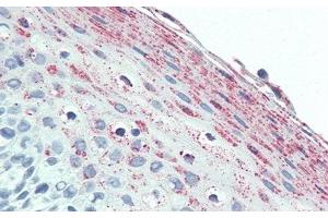 Detection of UCN2 in Human Tonsil Tissue using Polyclonal Antibody to Urocortin 2 (UCN2) (Urocortin 2 Antikörper  (AA 23-107))