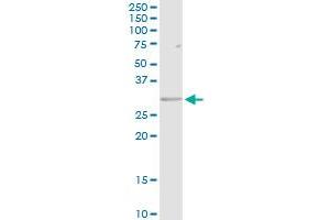 Western Blotting (WB) image for anti-Major Histocompatibility Complex, Class II, DR beta 5 (HLA-DRB5) (AA 1-266) antibody (ABIN516520)