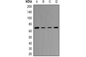 Western blot analysis of Transketolase expression in Jurkat (A), MCF7 (B), mouse liver (C), rat kidney (D) whole cell lysates.