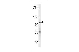 hGCN5 Antibody (C-term) (ABIN656132 and ABIN2845472) western blot analysis in mouse Neuro-2a cell line lysates (35 μg/lane). (KAT2A Antikörper  (C-Term))