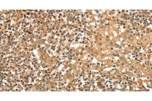 Immunohistochemistry of paraffin-embedded Human tonsil tissue using SLC8A3 Polyclonal Antibody at dilution 1:35 (SLC8A3 Antikörper)