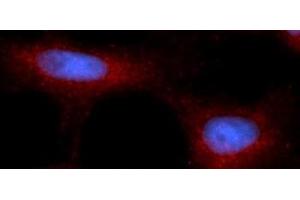 Immunofluorescence (IF) image for anti-Poly Binding Protein Interacting Protein 2 (PAIP2) (AA 1-127) antibody (PE) (ABIN5568398) (PAIP2 Antikörper  (AA 1-127) (PE))