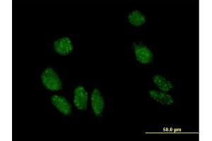 Immunofluorescence of purified MaxPab antibody to MYL5 on HeLa cell.