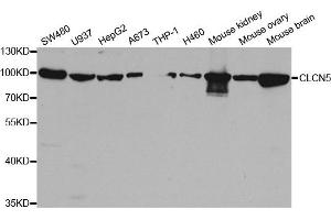 Western Blotting (WB) image for anti-Chloride Channel 5 (CLCN5) antibody (ABIN1876908)