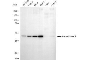 Western blotting analysis using aurora kinase A antibody (ABIN7797703).