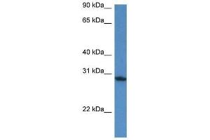 Western Blot showing Fam168a antibody used at a concentration of 1. (FAM168A Antikörper  (N-Term))