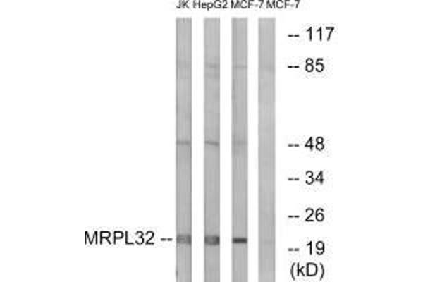 MRPL32 Antikörper