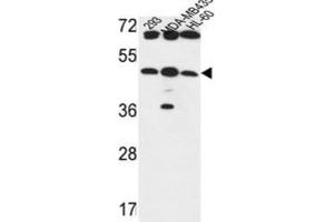 Western Blotting (WB) image for anti-UDP-GlcNAc:betaGal beta-1,3-N-Acetylglucosaminyltransferase 5 (B3GNT5) antibody (ABIN3004261) (B3GNT5 Antikörper)