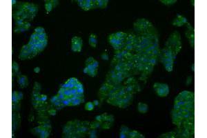 Image no. 6 for anti-V-Akt Murine Thymoma Viral Oncogene Homolog 2 (AKT2) antibody (ABIN1496564) (AKT2 Antikörper)
