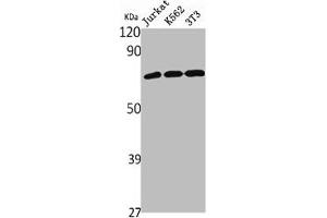 Western Blotting (WB) image for anti-Solute Carrier Family 9, Subfamily A (NHE9, Cation Proton Antiporter 9), Member 9 (SLC9A9) (Internal Region) antibody (ABIN7187503)