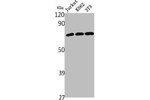 Western Blot analysis of Jurkat K562 NIH-3T3 cells using NHE-9 Polyclonal Antibody (SLC9A9 Antikörper  (Internal Region))