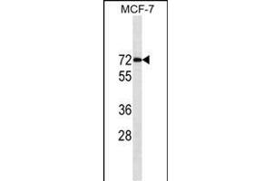 ESR1/ER Antibody (ABIN1539856 and ABIN2843829) western blot analysis in MCF-7 cell line lysates (35 μg/lane). (Estrogen Receptor alpha Antikörper  (AA 246-273))