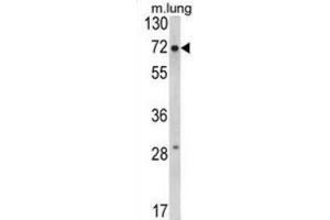 Western Blotting (WB) image for anti-Fragile X Mental Retardation 1 (FMR1) antibody (ABIN3002852) (FMR1 Antikörper)