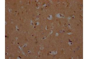 IHC image of ABIN7139952 diluted at 1:200 and staining in paraffin-embedded human brain tissue performed on a Leica BondTM system. (OR1A2 Antikörper  (AA 247-262))