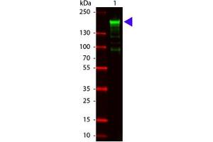 Image no. 1 for anti-alpha-2-Macroglobulin (A2M) antibody (ABIN799706) (alpha 2 Macroglobulin Antikörper)