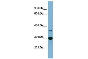 BDH2 antibody used at 1 ug/ml to detect target protein.