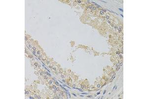 Immunohistochemistry of paraffin-embedded human prostate using NAPA antibody. (NAPA Antikörper)