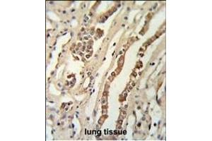 GMNN Antibody (Center ) (ABIN651420 and ABIN2840228) IHC analysis in formalin fixed and paraffin embedded lung tissue followed by peroxidase conjugation of the secondary antibody and DAB staining. (Geminin Antikörper  (AA 96-123))