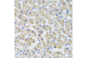 Immunohistochemistry of paraffin-embedded human liver injury using SNAP29 antibody. (SNAP29 Antikörper)