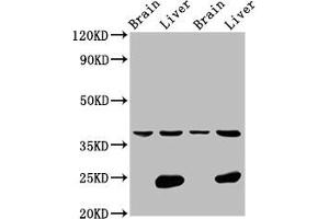 Western Blot Positive WB detected in: Rat brain tissue, Rat liver tissue, Mouse brain tissue, Mouse liver tissue All lanes: LSAMP antibody at 4. (LSAMP Antikörper  (AA 168-287))