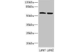 Western blot All lanes: FTCD antibody at 5. (FTCD Antikörper  (AA 412-541))
