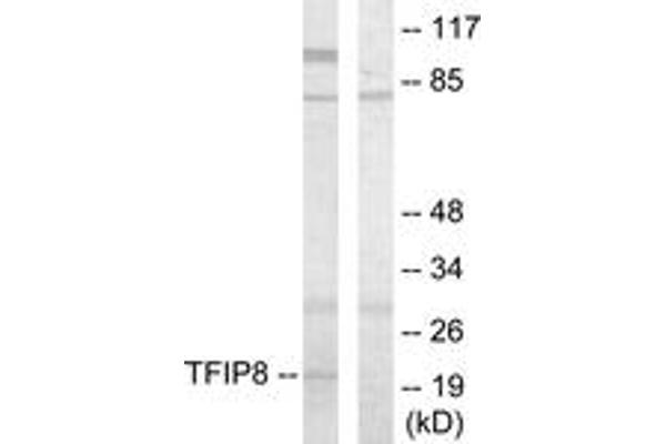 TNFAIP8 Antikörper  (AA 31-80)