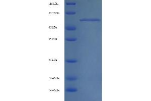 SDS-PAGE (SDS) image for Mixed Lineage Kinase Domain-Like (MLKL) (AA 1-471), (full length) protein (His tag) (ABIN5714442) (MLKL Protein (AA 1-471, full length) (His tag))