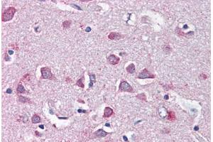 Human Brain, Cortex (formalin-fixed, paraffin-embedded) stained with NF2 antibody ABIN337064 at 5 ug/ml followed by biotinylated anti-goat IgG secondary antibody ABIN481715, alkaline phosphatase-streptavidin and chromogen. (Merlin Antikörper  (AA 526-536))