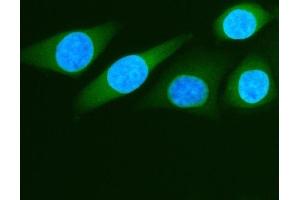 IF analysis of ALDH1A3 using anti-ALDH1A3 antibody (ABIN5518802). (ALDH1A3 Antikörper  (AA 37-154))