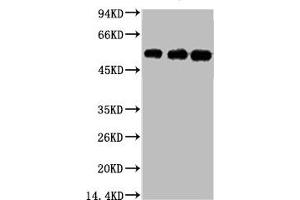 Western blot analysis of 1) Hela, 2) Mouse Brain tissue, 3) Rat Brain tissue, diluted at 1:5000. (TUBB3 Antikörper)