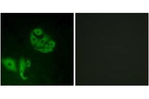 Immunofluorescence analysis of A549 cells, using GPR20 Antibody.