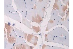DAB staining on IHC-P; Samples: Rat Skeletal muscle Tissue (SCGN Antikörper  (AA 1-276))