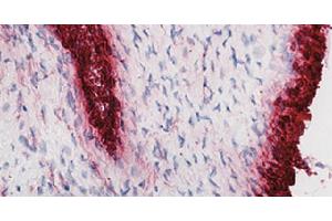 Frozen human synovial tissue section from patient with osteoarthritis was stained with hematoxylin and eosin and Mouse Anti-Human CD55-UNLB followed by a secondary antibody and colorimetric substrate. (CD55 Antikörper)