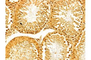 ABIN6263677 and ABIN6273060 at 1/100 staining Rat testis tissue by IHC-P. (NOB1 Antikörper  (C-Term))