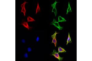 ABIN6263468 and ABIN6272966 staining Hela cells by IF/ICC. (MYH7 Antikörper  (C-Term))