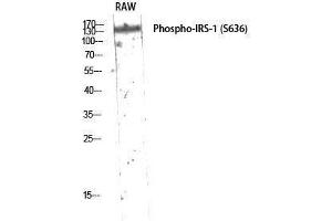 Western Blotting (WB) image for anti-Insulin Receptor Substrate 1 (IRS1) (pSer636) antibody (ABIN3182047) (IRS1 Antikörper  (pSer636))