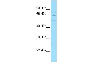 WB Suggested Anti-Wasf2 Antibody   Titration: 1. (WASF2 Antikörper  (Middle Region))